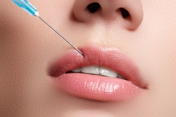Comment redessiner les lèvres avec l’acide hyaluronique ?